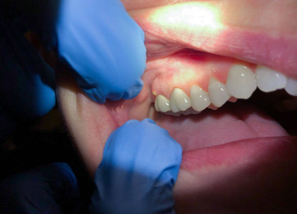 Best Same-Day Emergency Dentist in Olivet, NJ