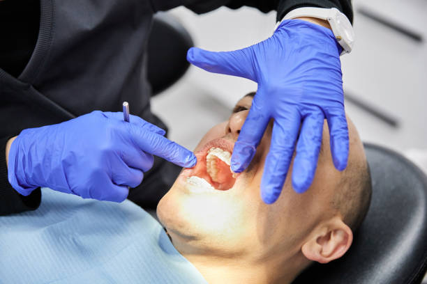 Best Emergency Treatment for Toothache in Olivet, NJ