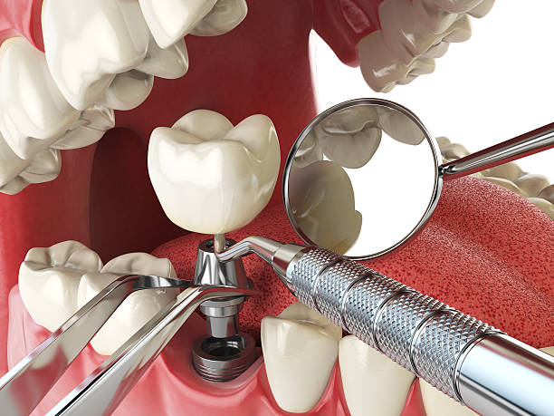 Best Weekend Emergency Dentist in Olivet, NJ